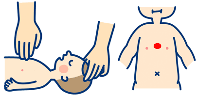 赤ちゃんの場合の胸骨圧迫